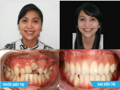 Công trình nghiên cứu khoa học của Ts.Bs Võ Văn Nhân Công trình nghiên cứu khoa học của Ts.Bs Võ Văn Nhân